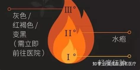 八字有童子煞怎么破_什么八字犯童子煞,第5张 八字有童子煞怎么破_什么八字犯童子煞,第5张